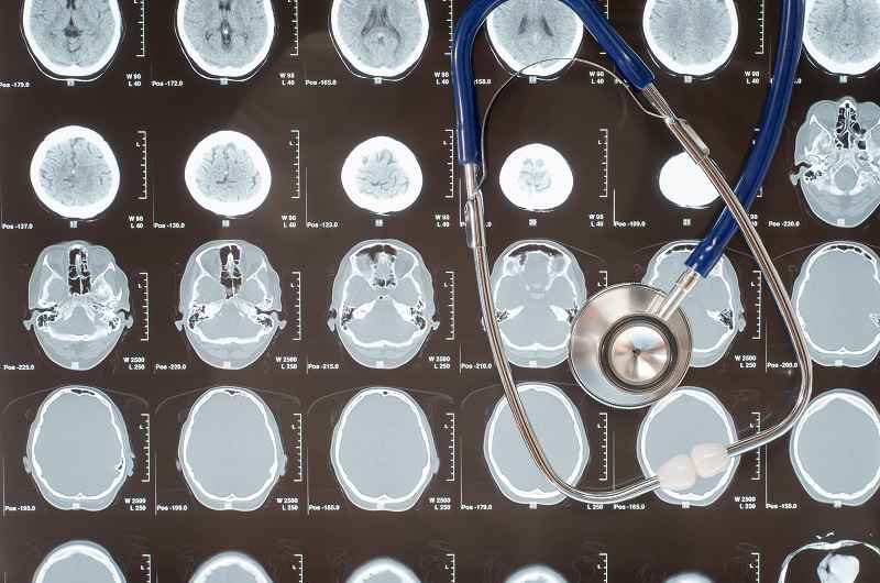 Objective Assessment of Mild Head Injury with the Ahead 300 - Medical News Bulletin