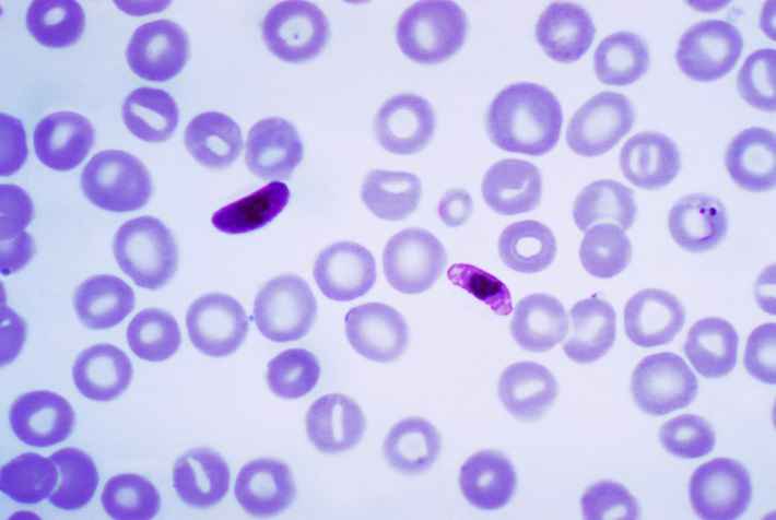 treatment of malaria