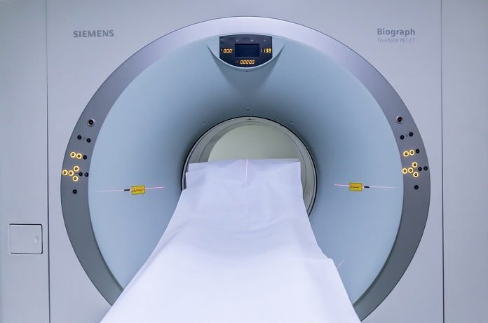 Can MRI Brain Scans Help Us Understand Epilepsy? epilepsy