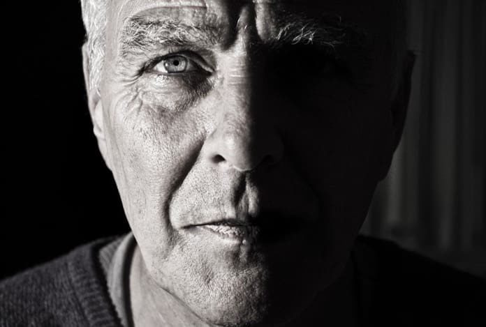 Alzheimer's disease