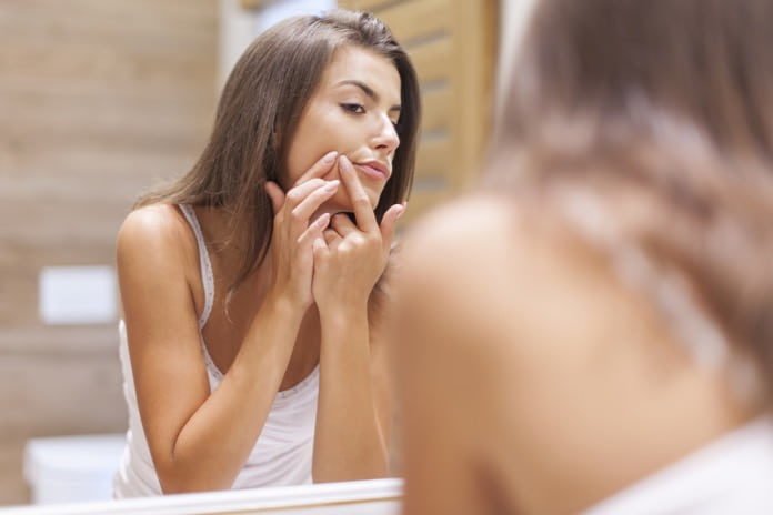 chemical peel for acne
